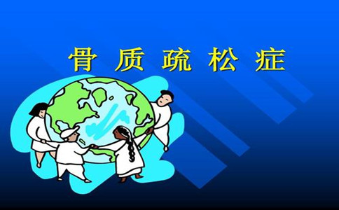 骨密度檢測(cè)