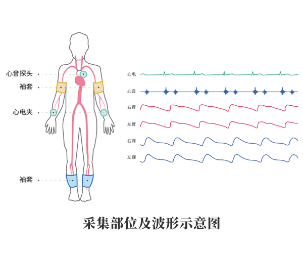 動脈硬化檢測儀產(chǎn)品應用